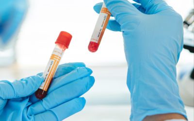 Blood Test
